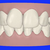 ClinCheck - Before View