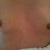 This is before shot. One boob looks higher because I am holding the camera up. Front picture.