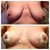 Before and after, 1 day