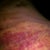 OUCHIES!!
