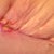 Upper left- bump. Lower left- open wound. Plus "pleated" skin folds. :/