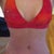 Almost 12 weeks post op. Hot damn!!! Lol