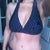 9 wks post op, old bikini from my before pic on the new body