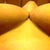 t-junctions - 9 months post op