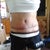 4 Week Post op of belly and Scars.