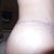 3 week scar right