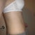2 weeks post op, side after a shower