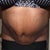 14 weeks not breathing, slightly bent forward.