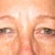 Very heavy eyelids..heredity