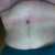 2 months out- a little swollen and pretty red but it will improve with time!