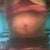 Still puffy six weeks out. I bought a stage 2 binder and it's helping.