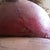 my left breast