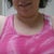 you can see a few of the stitches on my right side at the underarm