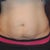 See that little mole right in the middle of my upper abdomen?!? It is now just above my belly button LOL!