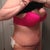 Day 6 post op