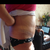 2 weeks post op
