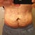 My "before" pic. Aug 2011.