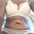 4 months PO...a little flabby - needs some cardio or maybe lipo