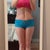 2 week post op front view with "cut impression"