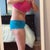 2 week post op side leaning over