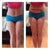 2 weeks After/Before