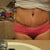 PO day 14 scar is low but not low enough for the new Vic Secret bikini I just bought..Oh well...