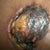 Right Nipple as of November 22