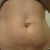 before, better look at hernia and how bulgy/poochy my belly was