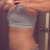 One week post lower ab