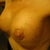 3 weeks post-op getting there !  scabing around the nipple looks worse on the picture and only superficial, its already starting to flake off :)