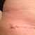 Right side where I thought may be a dog ear, but PS said he is confident that it will be fine.