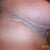 Post op week 5