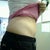 3 Weeks PO