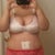 1 Day post op