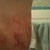 after day 2 very very swollen