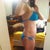 12 days post op side