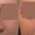 My nose | Doctor's image of what my nose might look like