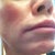 Close up of lips with no bruising