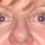 This is my before nose