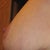 9 months Left Lateral
