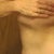 9 months Scars under right breast
