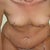 bending forward 4 days Post OP