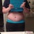 Thin scar :) I'm so happy! Tummy and Hips are still swollen