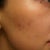 3 weeks after