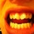 Front View. Before Invisalign.