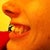 Side View. Before Invisalign.