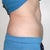 One week after second treatment (small applicator to upper and lower abs)