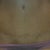 The scar 1 year
