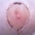 Day 20:  Right nipple.  You can see the red scabs from where the skin peeled off.  Looked freaky when it was glistening pink without the scab!  They're healing up though, and I do think they'll look fine when they're done healing.