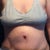 this is sometime in the first or second week. Really swollen